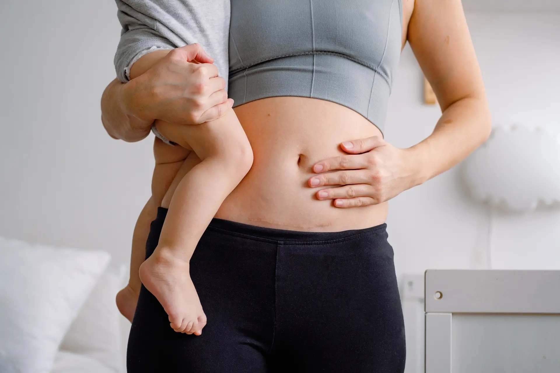 Pelvic Floor Physiotherapy Edmonton 3 Woman holding a child while touching her abdomen, representing postpartum recovery and Pelvic Floor Physiotherapy Edmonton support.